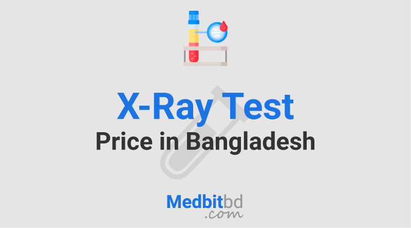 X-Ray Test Price in Dhaka